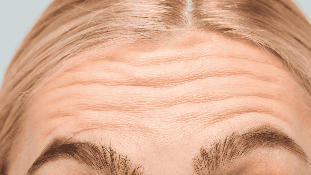 Wrinkles Treatment in Sydney, Australia