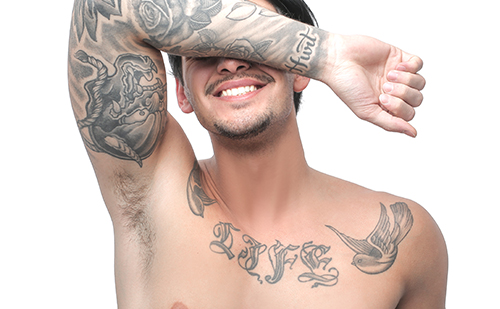 CHNG  Laser Tattoo Removal  New York City